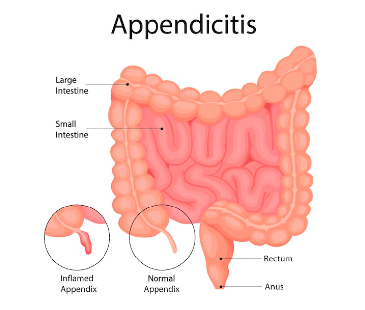 Dr. Gandhi Surgery Centre | Best Surgeon in Delhi